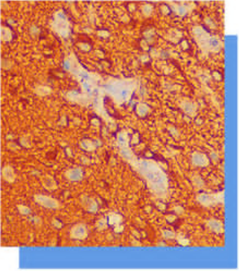 膠質(zhì)纖維酸性蛋白（Glial Fibrillary Acidic Protein，GFAP）抗體試劑